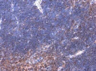 Immunohistochemistry-Paraffin: BTK [p Tyr223] Antibody [NBP3-12916]